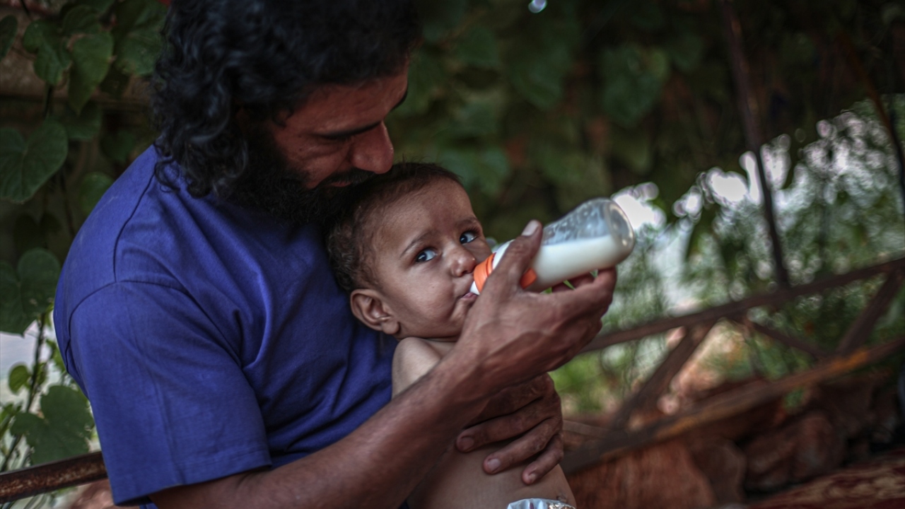 Halit Mısaytıf, the father of little Muhammed, said in a statement that his son was born without arms and legs.