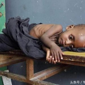 Pity the image of skinny African children because of hunger