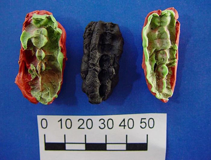 DNA From 10,000-Year-Old Scandinavian Chewing Gum Reveals Stone Age Diet