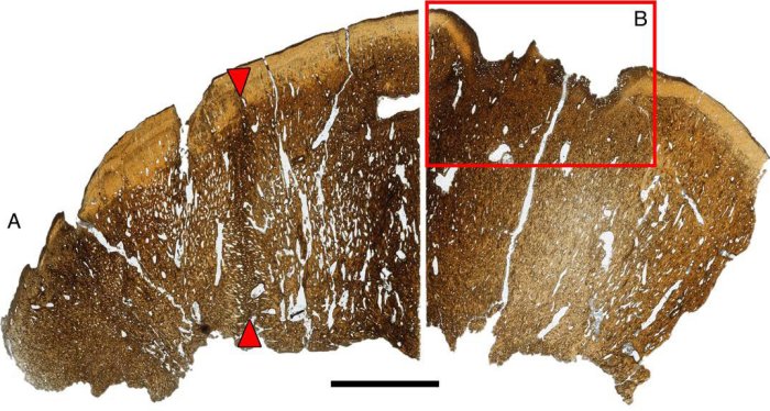 Newly Described Species Of Dome-Headed Dinosaur May Have Sported Bristly Headgear