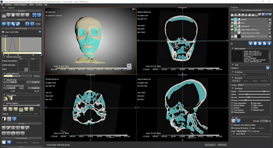 King Tut's Face Reconstructed By Bioarchaeologist