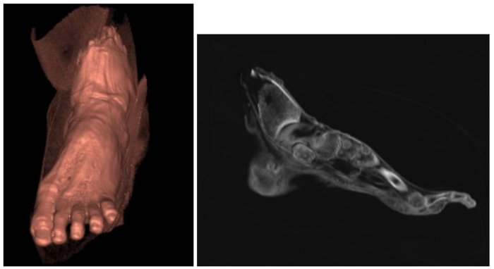 Little-Known Mummy Fragments Analyzed By Scientists