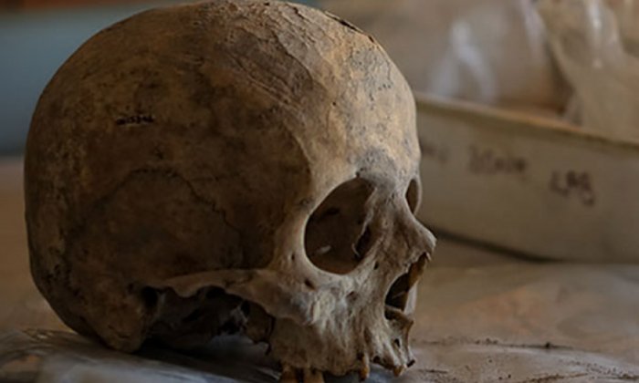 A human skull is placed on a table at the Çatalhöyük Human Remains Laboratory in Konya, Turkey