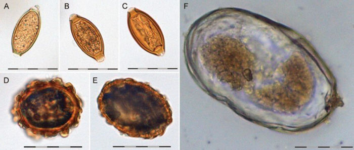 DNA In Viking Poop Sheds New Light On 55,000-Year-Old Relationship Between Gut Companions